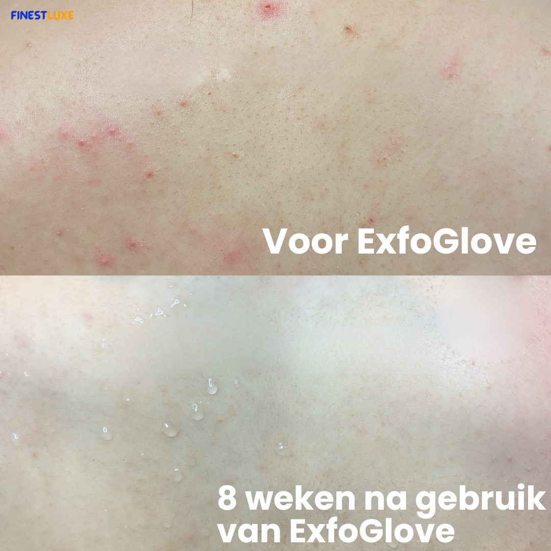 ExfoGlove | Natuurlijke Scrubhandschoen voor Zichtbaar Gladdere Huid