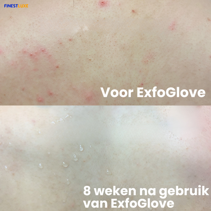 ExfoGlove | Natuurlijke Scrubhandschoen voor Zichtbaar Gladdere Huid
