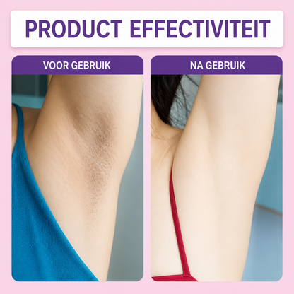 SilkFace | Voor Een Gladde Huid Zonder Irritatie