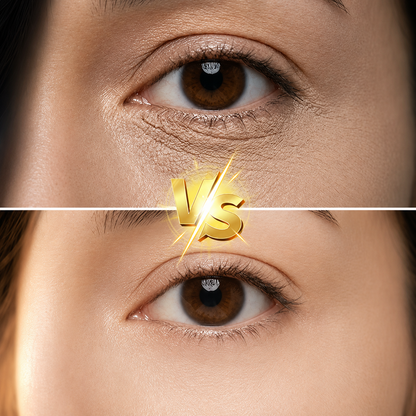 EyeGel | Egale huid onder de ogen in één stap