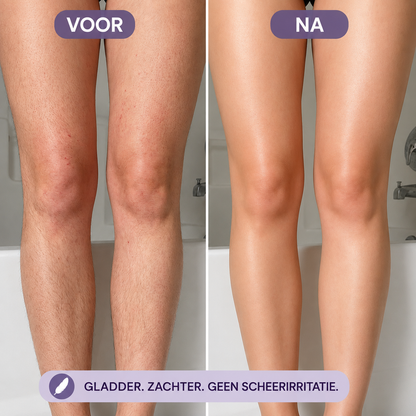 SilkyMousse | Gladde Huid Zonder Scheerirritatie