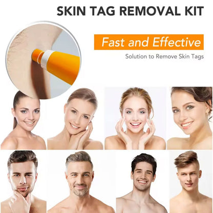 DermaFix | Complete Skin-Tag Remover Kit