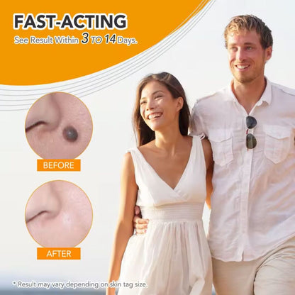 DermaFix | Complete Skin-Tag Remover Kit