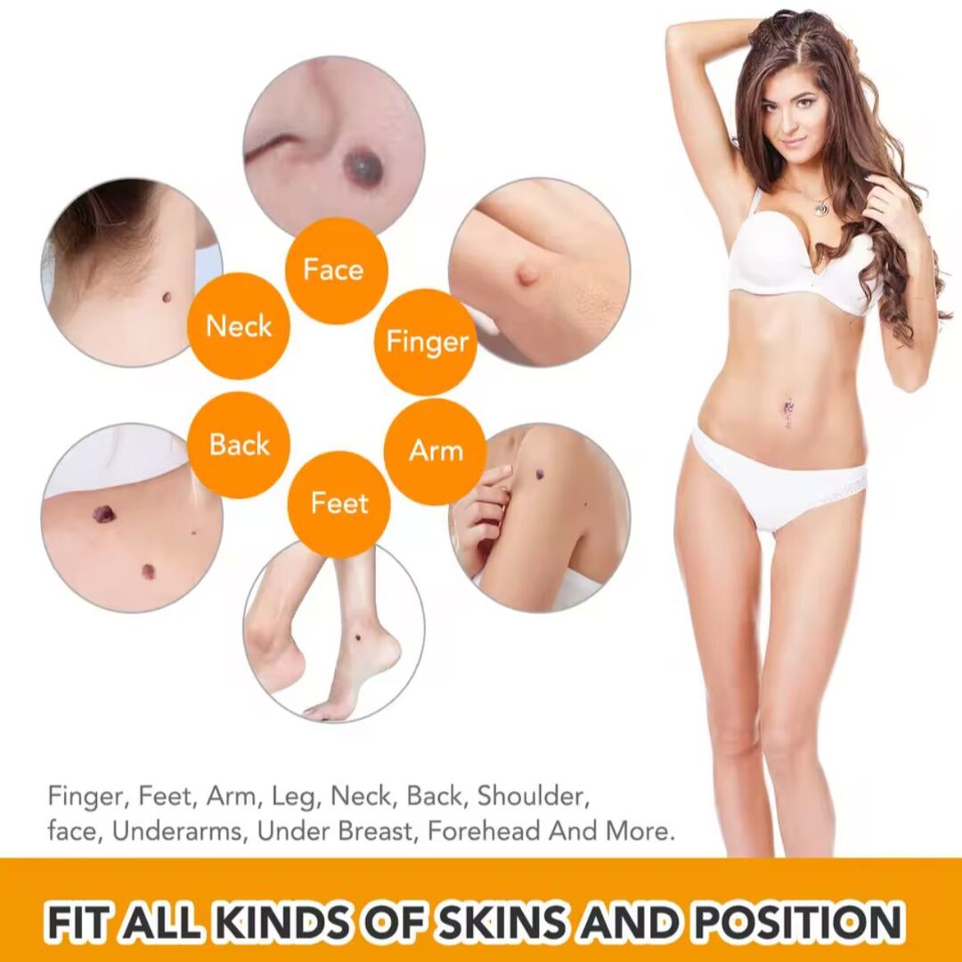 DermaFix | Complete Skin-Tag Remover Kit