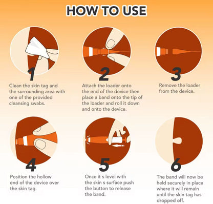 DermaFix | Complete Skin-Tag Remover Kit