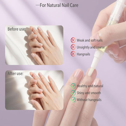 ProNail | Stamcelbehandeling voor Gezonde, Glanzende Nagels