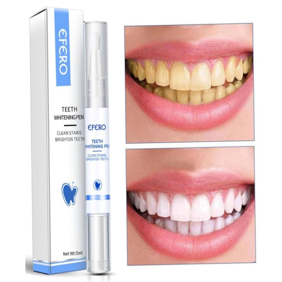 WhiteGlow | Professionele Whitening Waar je ook Bent