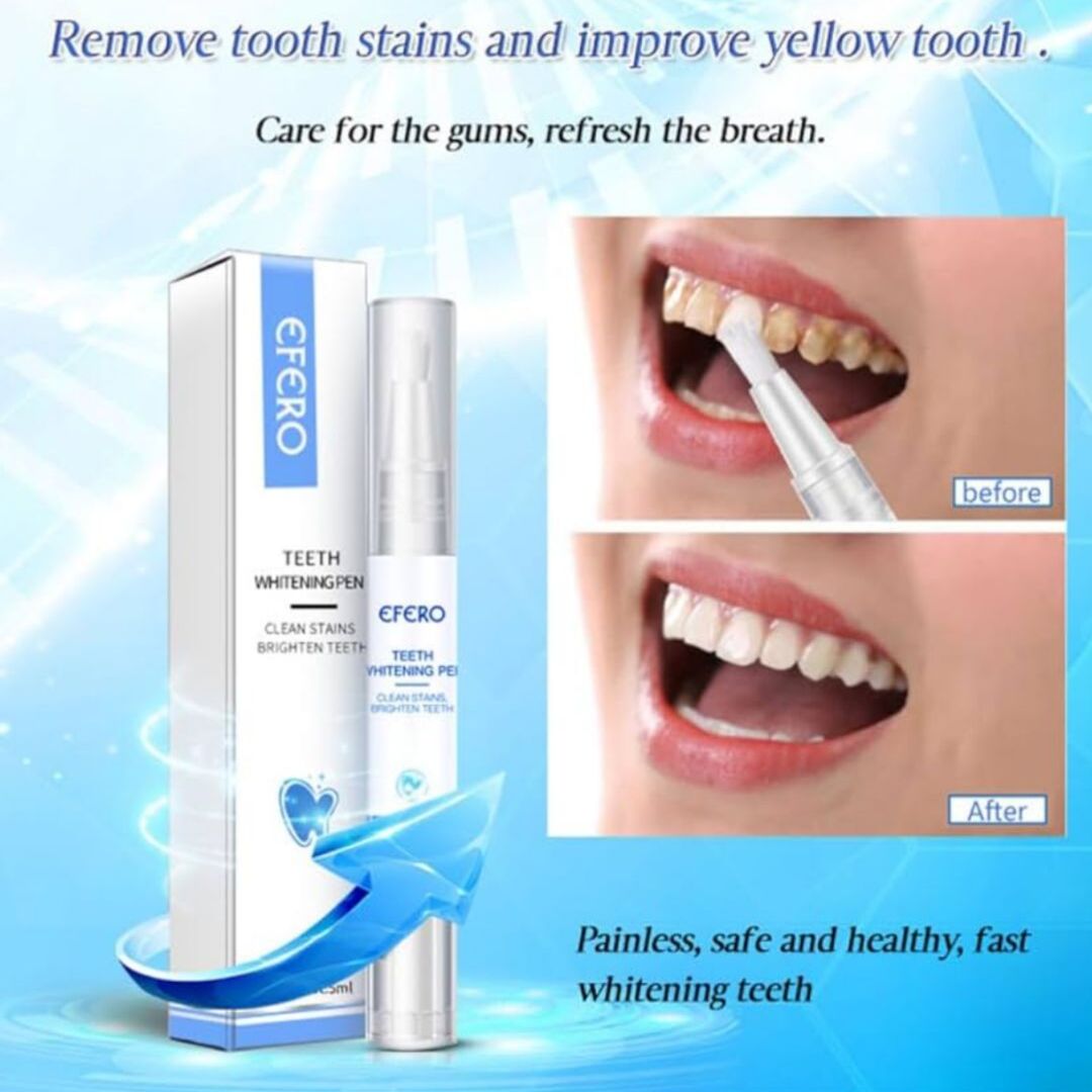 WhiteGlow | Professionele Whitening Waar je ook Bent