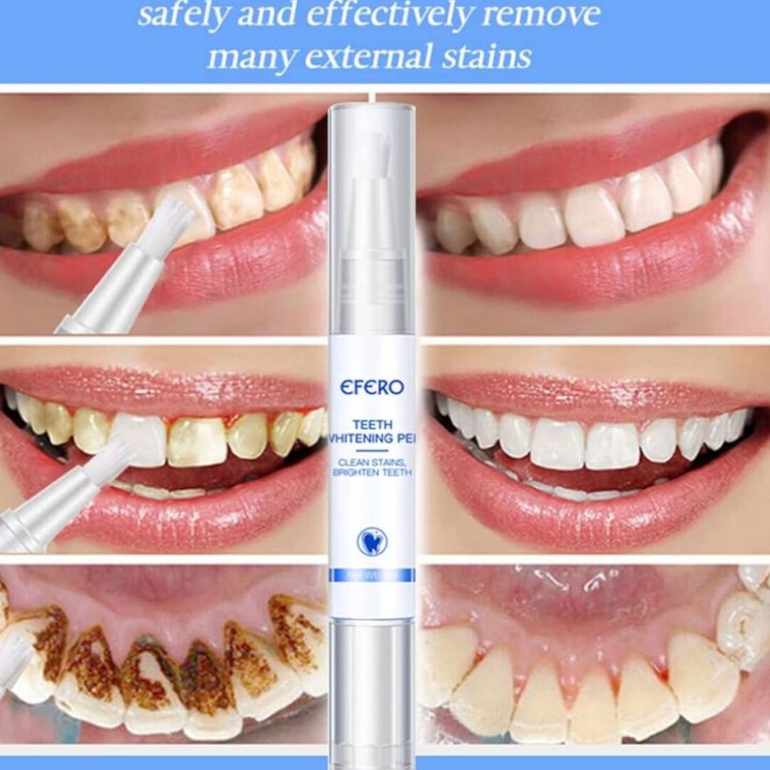 WhiteGlow | Professionele Whitening Waar je ook Bent
