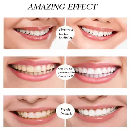 WhiteGlow | Professionele Whitening Waar je ook Bent