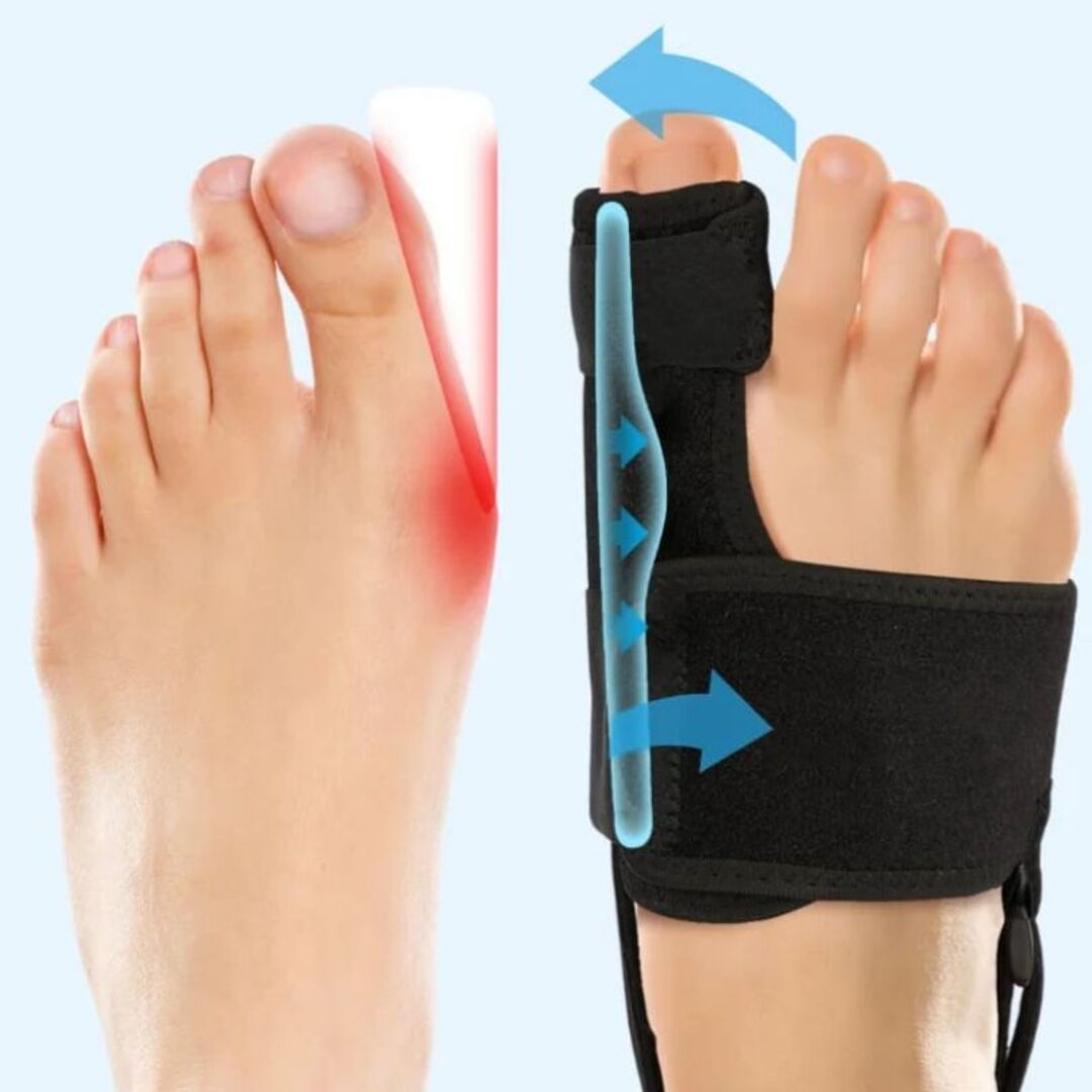 StepWell | Corrigerende Teenbrace voor Comfort & Mobiliteit