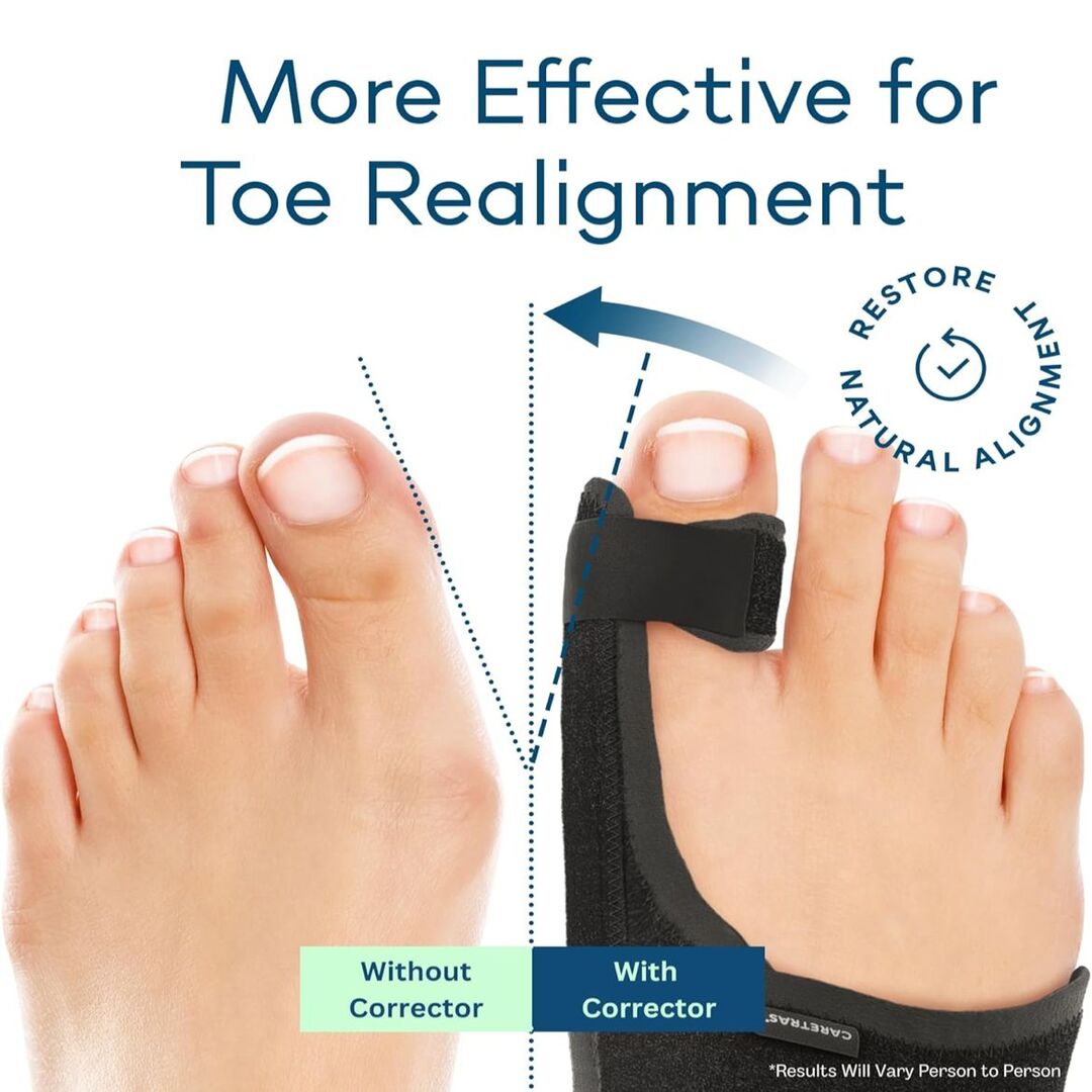 StepWell | Corrigerende Teenbrace voor Comfort & Mobiliteit