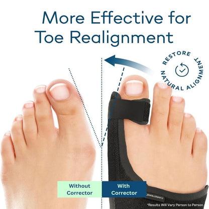 StepWell | Corrigerende Teenbrace voor Comfort & Mobiliteit